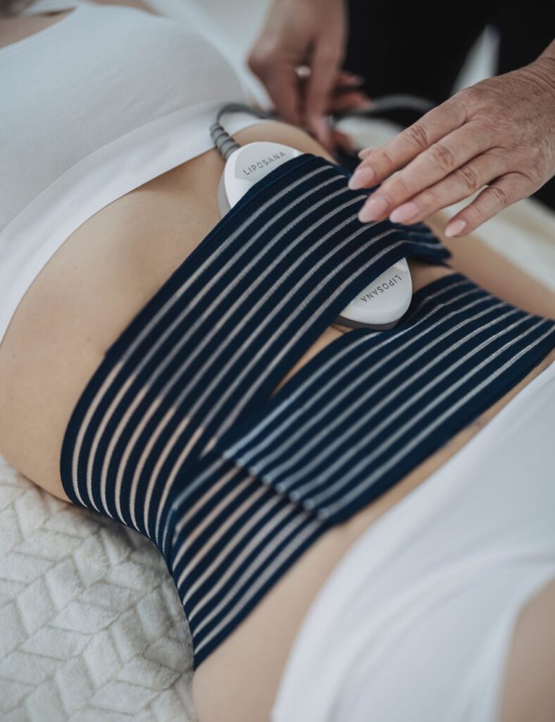 Gezielte Bauchbehandlung mit Liposana 3+ im Vitalraum Lörrach – moderne Technik für Figurformung und Hautstraffung